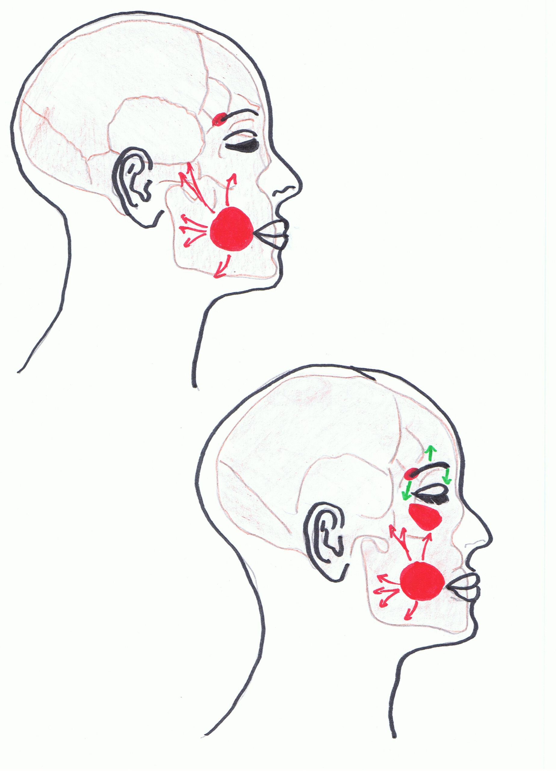 Schéma illustrant les traitements esthétiques faciaux avec des flèches indiquant les zones d’intervention.