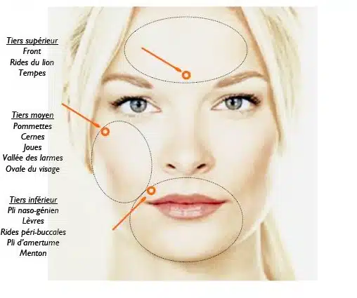 Diagramme facial décrivant les zones clés pour les traitements esthétiques : tiers supérieur, moyen et inférieur.